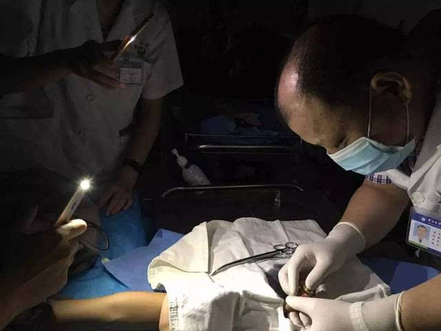 剖腹产后能吃火锅吗?女性剖腹产后还能照常吃酱油吗?