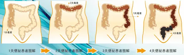 洗牙的好处和坏处有哪些？这几点你都清楚吗？