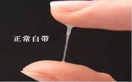 女性白带发红是什么原因导致的?白带发黑是什么原因引起的呢?