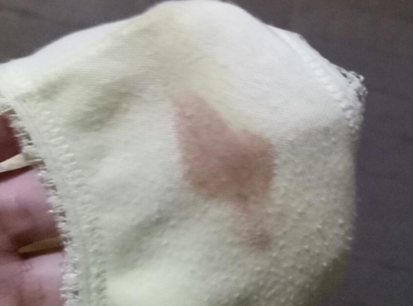 白带褐色是什么原因引起的呢?女性的白带呈褐红色已有5天什么情况?